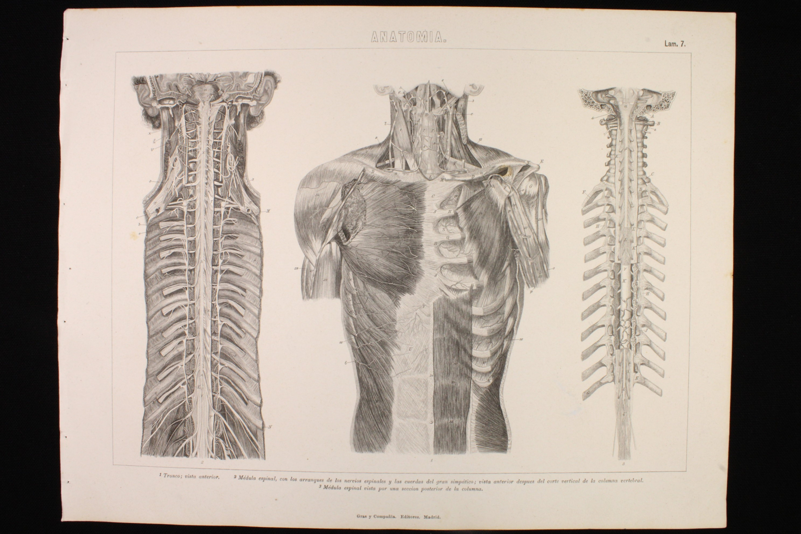 Antiguedades de grabado anatomia lamina gras y c tronco y medula espinal